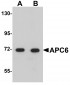 APC6 Antibody