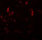 PIAS2 Antibody