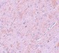 PIAS2 Antibody