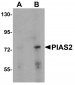 PIAS2 Antibody