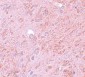 PIAS4 Antibody