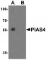 PIAS4 Antibody
