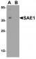 SAE1 Antibody