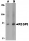 RBBP8 Antibody