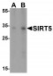SIRT5 Antibody