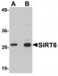 SIRT6 Antibody
