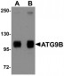 ATG9B Antibody