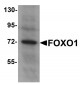 FOXO1 Antibody