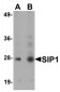 SIP1 Antibody