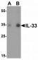 ZEB1 Antibody