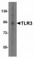 ZEB1 Antibody