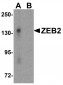 ZEB2 Antibody