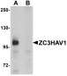 ZC3HAV1 Antibody