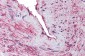 SCUBE3 Antibody