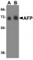 AFP Antibody