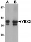 YBX2 Antibody