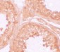 NOD6 Antibody