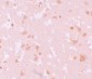 NALP7 Antibody