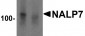 NALP7 Antibody