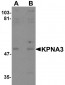 KPNA3 Antibody