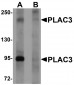 PLAC3 Antibody