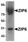 ZIP6 Antibody