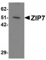 ZIP7 Antibody