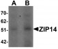 ZIP14 Antibody