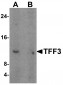 TFF3 Antibody