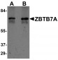 ZBTB7A Antibody