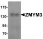 ZMYM3 Antibody