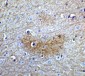 Bcl9L Antibody