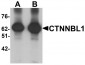 CTTNBL1 Antibody