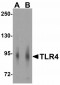 GLS2 Antibody