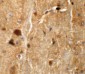 TMEM192 Antibody