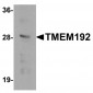 TMEM192 Antibody