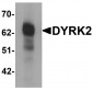 DYRK2 Antibody