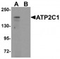 ATP2C1 Antibody