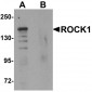 ROCK1 Antibody