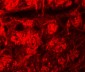 ROCK2 Antibody