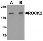 ROCK2 Antibody