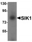SIK1 Antibody