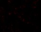 SIK2 Antibody