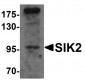 SIK2 Antibody