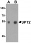 SPT2 Antibody