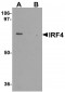 IRF4 Antibody