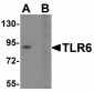 MSI2 Antibody