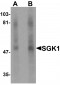 SGK1 Antibody