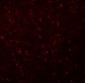 AP3M1 Antibody