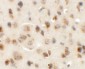 AP3M1 Antibody